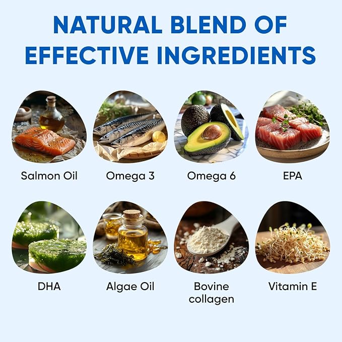 Omega 3 Fish Oil for Dogs Chews - Dog Skin & Coat Supplement for Itch Relief, Hot Spot Treatment - USA Product - Salmon Oil for Dogs Itching Skin Relief, Shedding, Hip & Joint Health - 120 Soft Treats