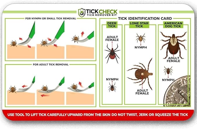 TickCheck Premium Tick Remover Kit - Stainless Steel Tick Remover + Tweezers, Leather Case, and Free Pocket Tick Identification Card (50)