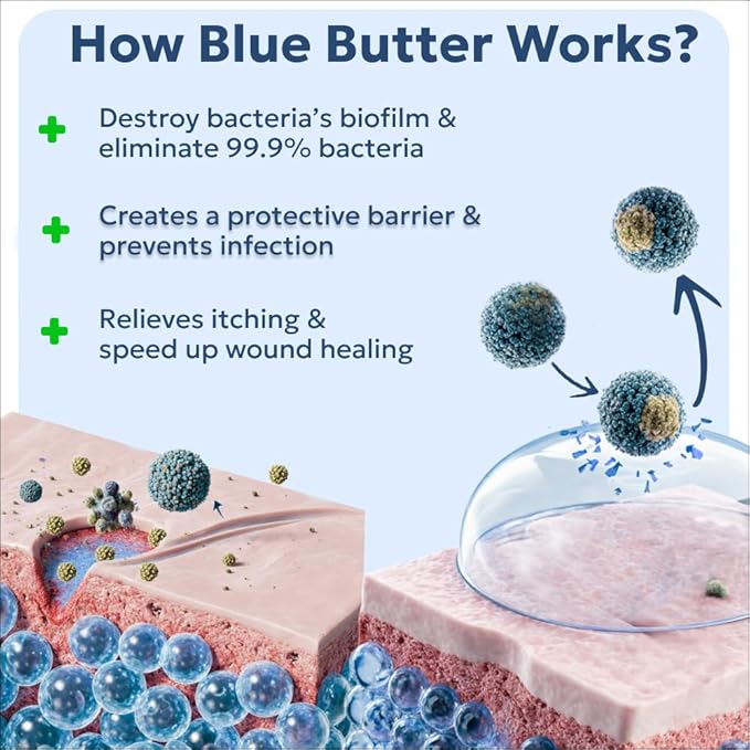 Forticept Blue Butter – Hot Spot Treatment for Dogs Cats | Dog Cat Wound Care | Skin Yeast Infections, Ringworm, Cuts, Rashes, First Aid Veterinary Strength Anti Itch Cream 4oz