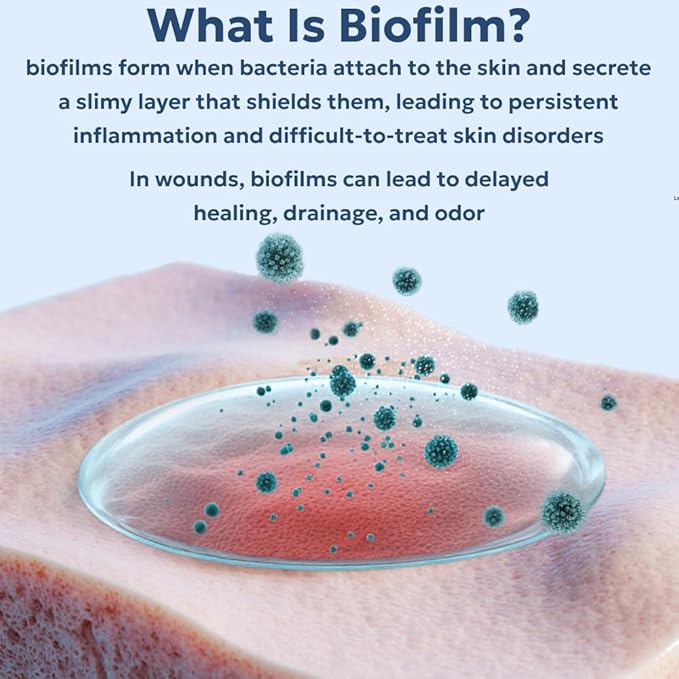 Forticept Blue Butter – Hot Spot Treatment for Dogs Cats | Dog Cat Wound Care | Skin Yeast Infections, Ringworm, Cuts, Rashes, First Aid Veterinary Strength Anti Itch Cream 4oz