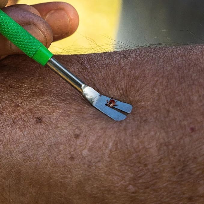 TickCheck Premium Tick Remover Kit - Stainless Steel Tick Remover + Tweezers, Leather Case, and Free Pocket Tick Identification Card (5)